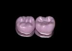 e.max restorations ready for crystallization following shaping and texturing refinements. 