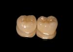 e.max HT (high transluceny) restorations following single step stain/glaze crystallization with e.max specific stains and glaze.