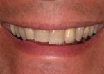  CEREC Happens.  