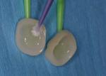 Apply Monobond silane to dry etched internal surface. 
