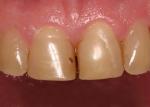  Pretreatment close up.