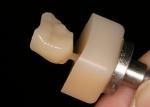 Milled IPS Empress CAD Multi blocks. 