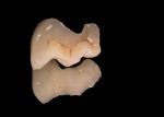 Glazing and some staining characterization maximizes function and aesthetics. 