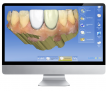 Featured CEREC Case
