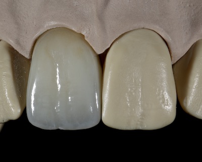 james Klim DDS, CEREC, Dentsply Sirona