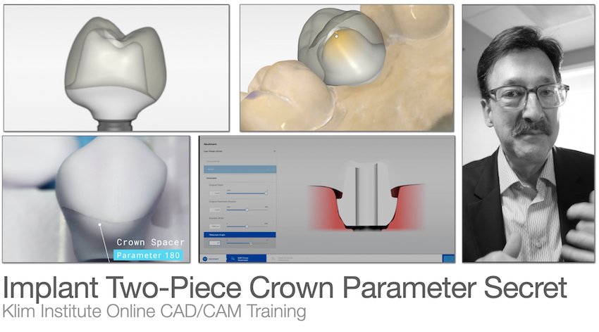 CEREC Implant Restoration