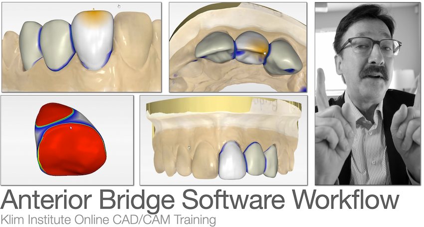 CEREC Bridge Software Workflow