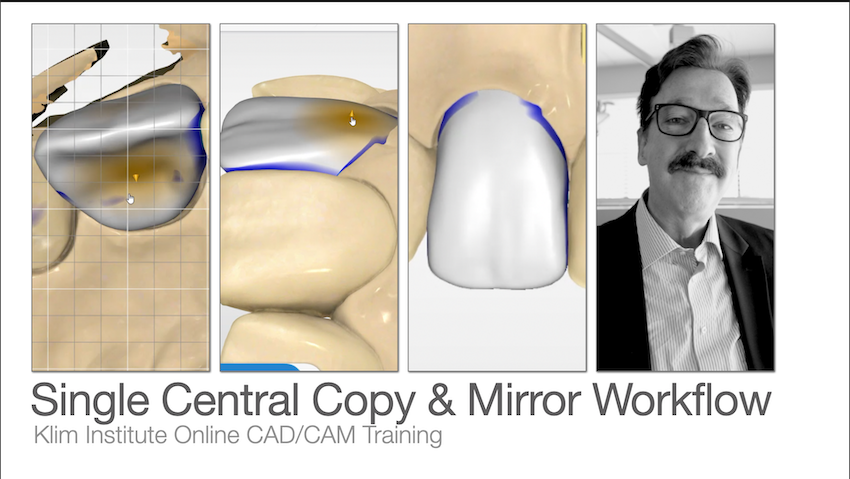 CEREC Software Bridge Workflow