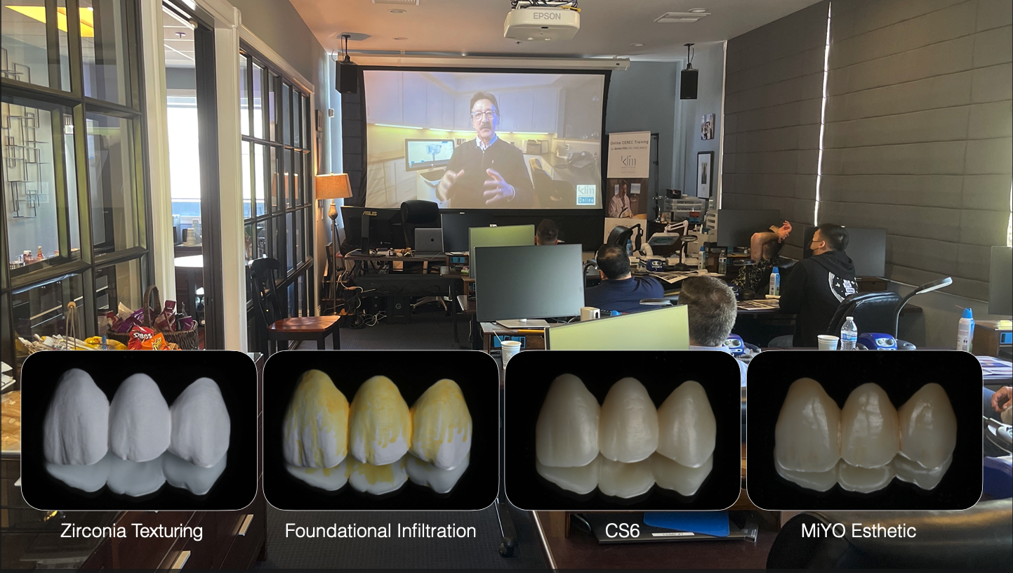 Zirconia Bridge