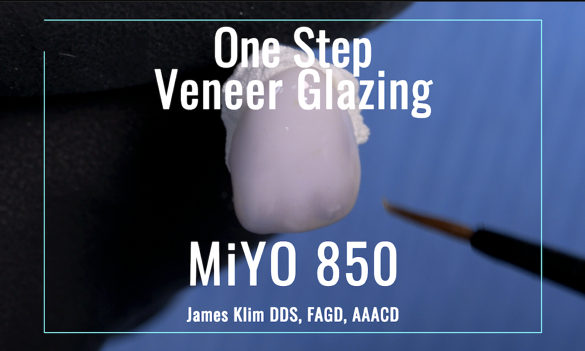 One Step Veneer Glazing
