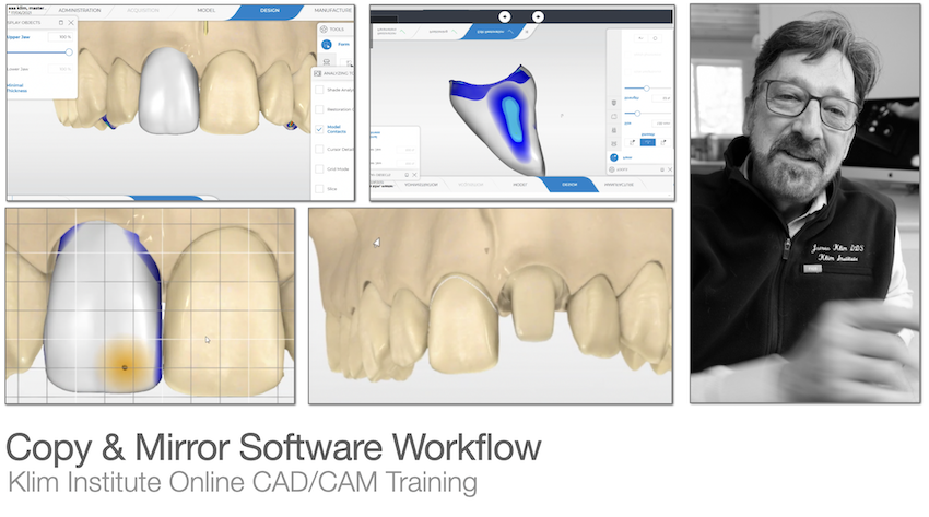 CEREC Copy and Mirror