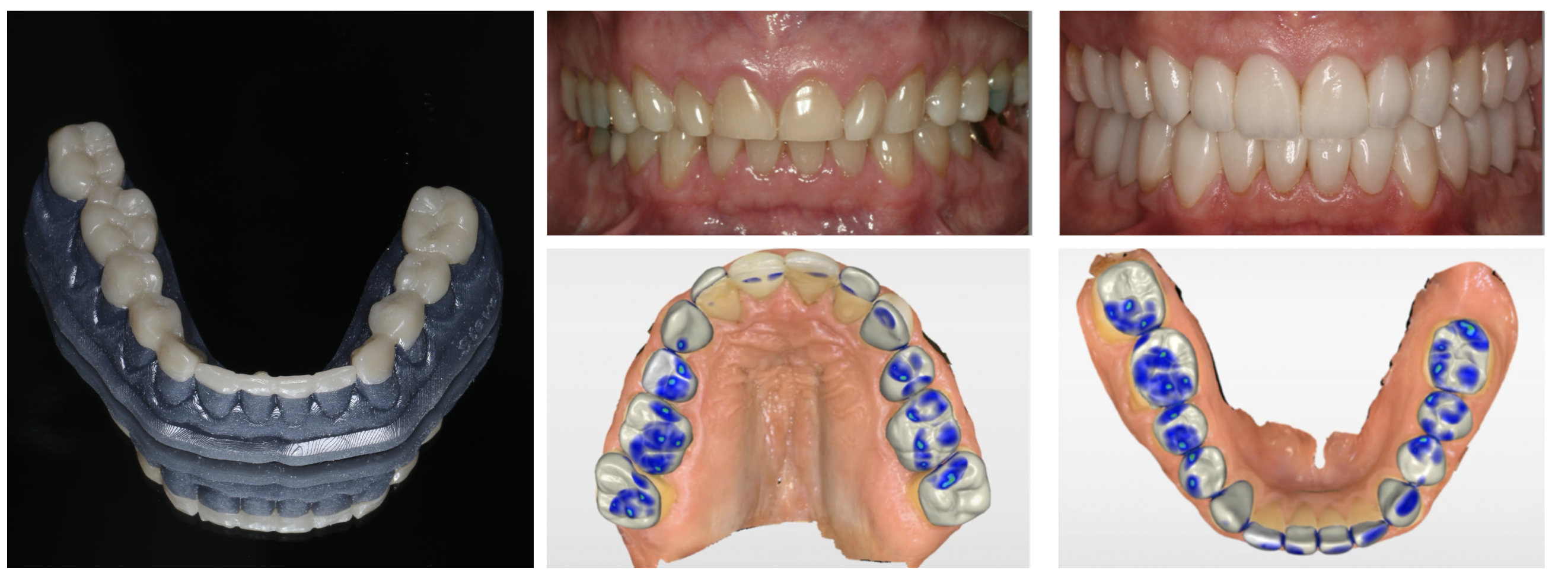 Comprehensive CAD/CAM Applications Course for CEREC users