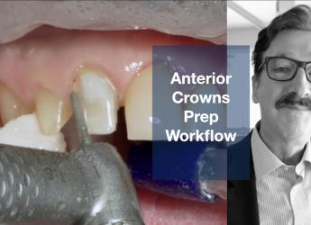 Anterior Crown Preparation Workflow