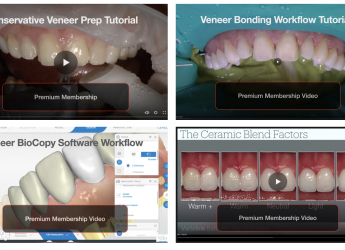 New Videos Posted on veneer techniques on cadcamdoctor.com 