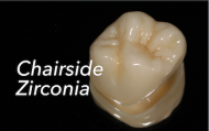 Chairside Zirconia