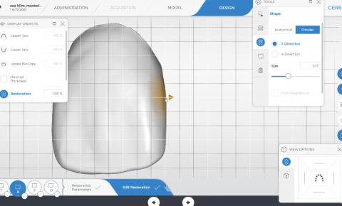 Designing the Midline in the CEREC Software