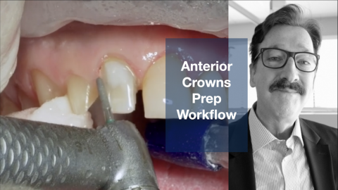 Anterior Crown Preparation Workflow