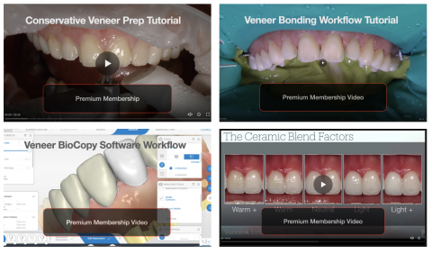 New Videos Posted on veneer techniques on cadcamdoctor.com 