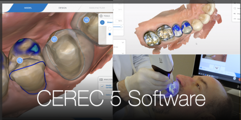 cerec tessera vs emax cerec tessera vs emax