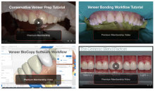 New Videos Posted on veneer techniques on cadcamdoctor.com 
