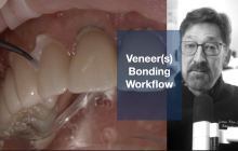 Veneer Bonding Workflow